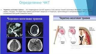 Отмена психотропных препаратов после черепно-мозговой травмы: необходимость инструкции